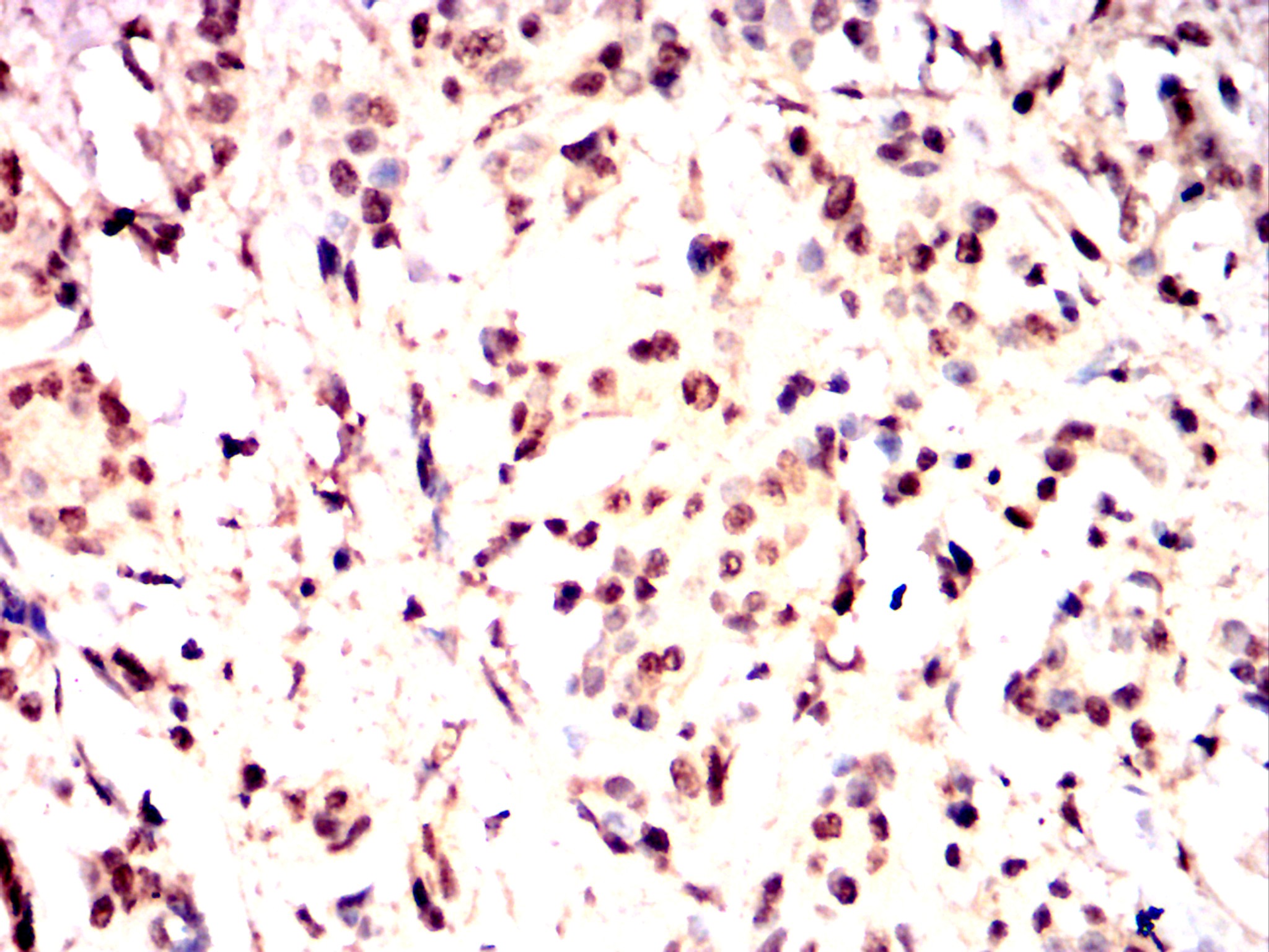 		IHC